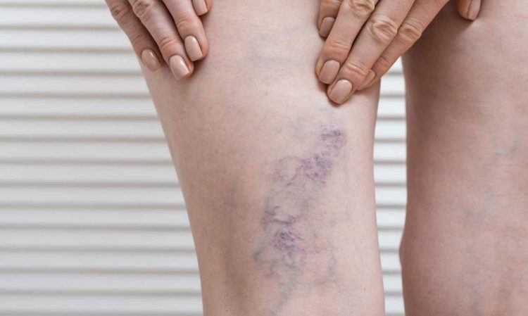 imagen-cuerpo imagen-cuerpo