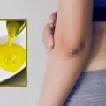 3 remedios naturales que te ayudarán a evitar la pigmentación en los codos