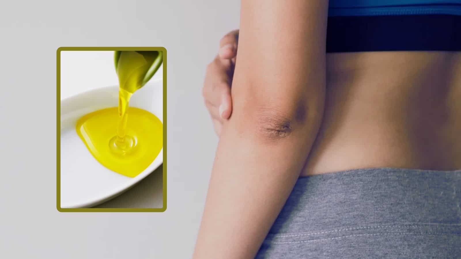 3 remedios naturales que te ayudarán a evitar la pigmentación en los codos