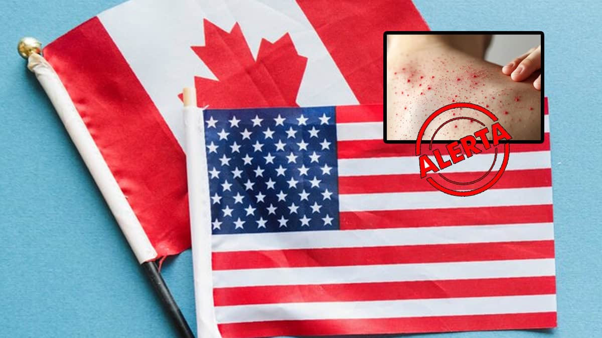 México alerta a quienes viajen a EU y Canadá por brote de sarampión