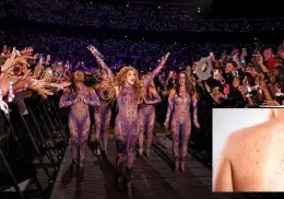 Detectan posible exposición masiva a sarampión en show de Shakira en EE. UU.