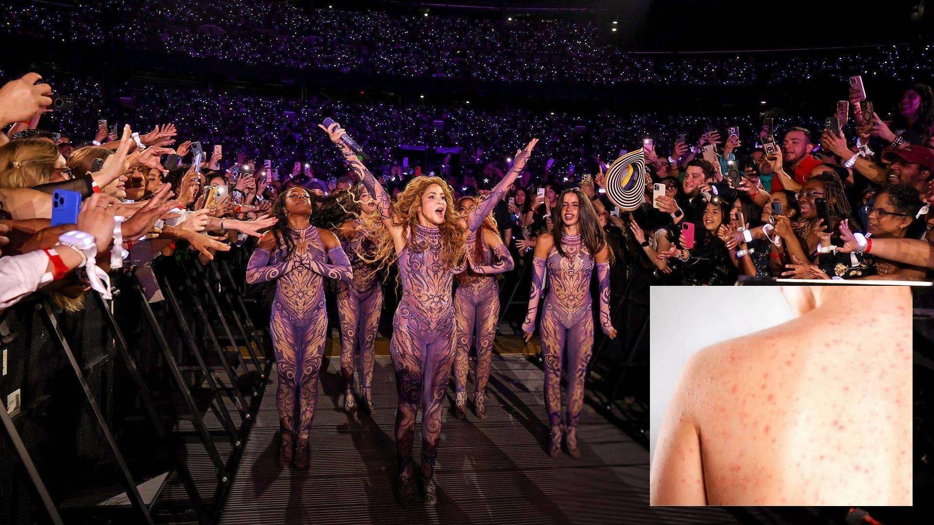 Detectan posible exposición masiva a sarampión en show de Shakira en EE. UU.