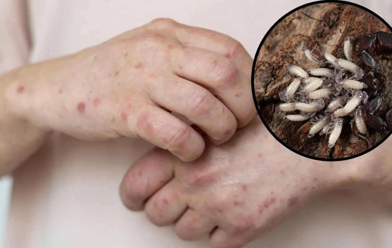 En Sonora las autoridades han establecido protocolos sanitarios para evitar afectaciones por gusano barrenador.