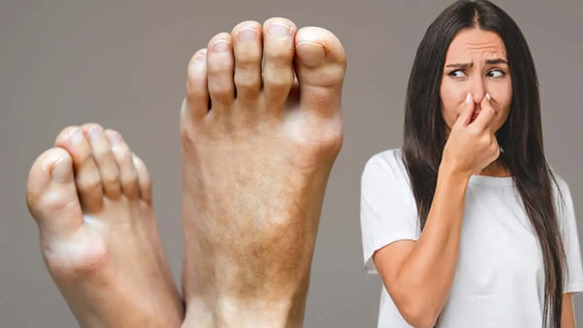 A esto se debe el mal olor de los pies. Experto te dice decimos cómo eliminarlo