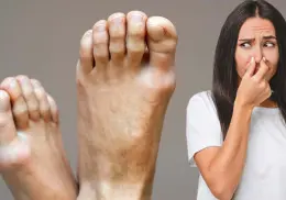 A esto se debe el mal olor de los pies. Experto te dice decimos cómo eliminarlo