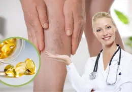 Dile adiós a las varices y arañitas de tus piernas con estas 3 poderosas vitaminas