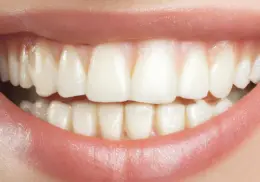 5 consejos efectivos para blanquear tus dientes de forma natural y cuidar tu salud bucal