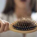 Así puedes evitar que se te caiga el cabello por estrés ¿Cuándo ir al médico?