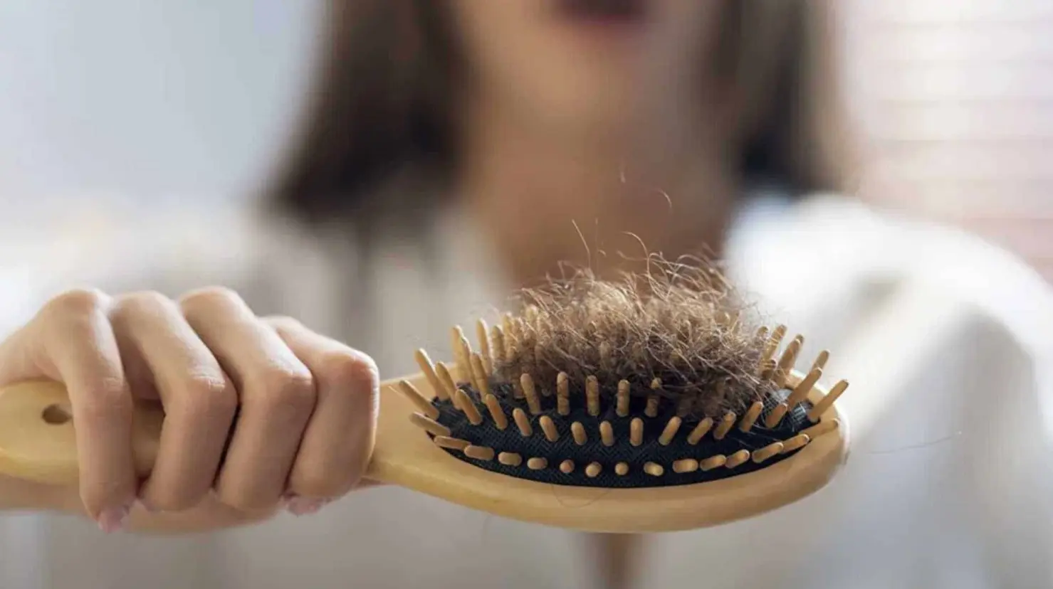 Así puedes evitar que se te caiga el cabello por estrés ¿Cuándo ir al médico?