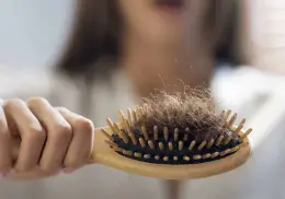 Así puedes evitar que se te caiga el cabello por estrés ¿Cuándo ir al médico?