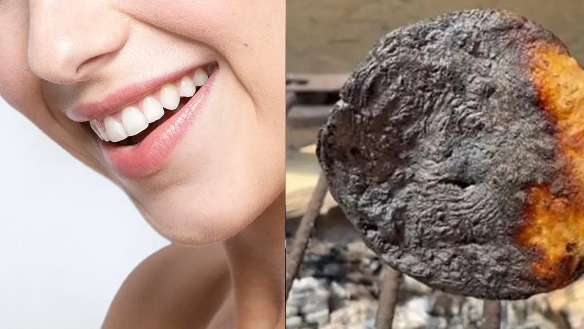 Tortilla quemada para blanquear los dientes: ¿Qué tan recomendable es?