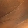 Estas manchas oscuras en el cuello son señales de alarma del cuerpo que avisan que algo anda mal