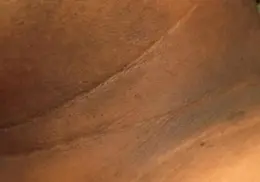 Estas manchas oscuras en el cuello son señales de alarma del cuerpo que avisan que algo anda mal