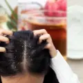3 mascarillas para el cabello que pueden ayudarte a combatir la caspa