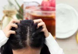 3 mascarillas para el cabello que pueden ayudarte a combatir la caspa