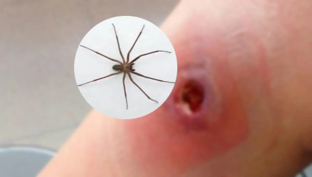 Aumentan casos de mordeduras de la araña violinista en 2025. Foto: Original