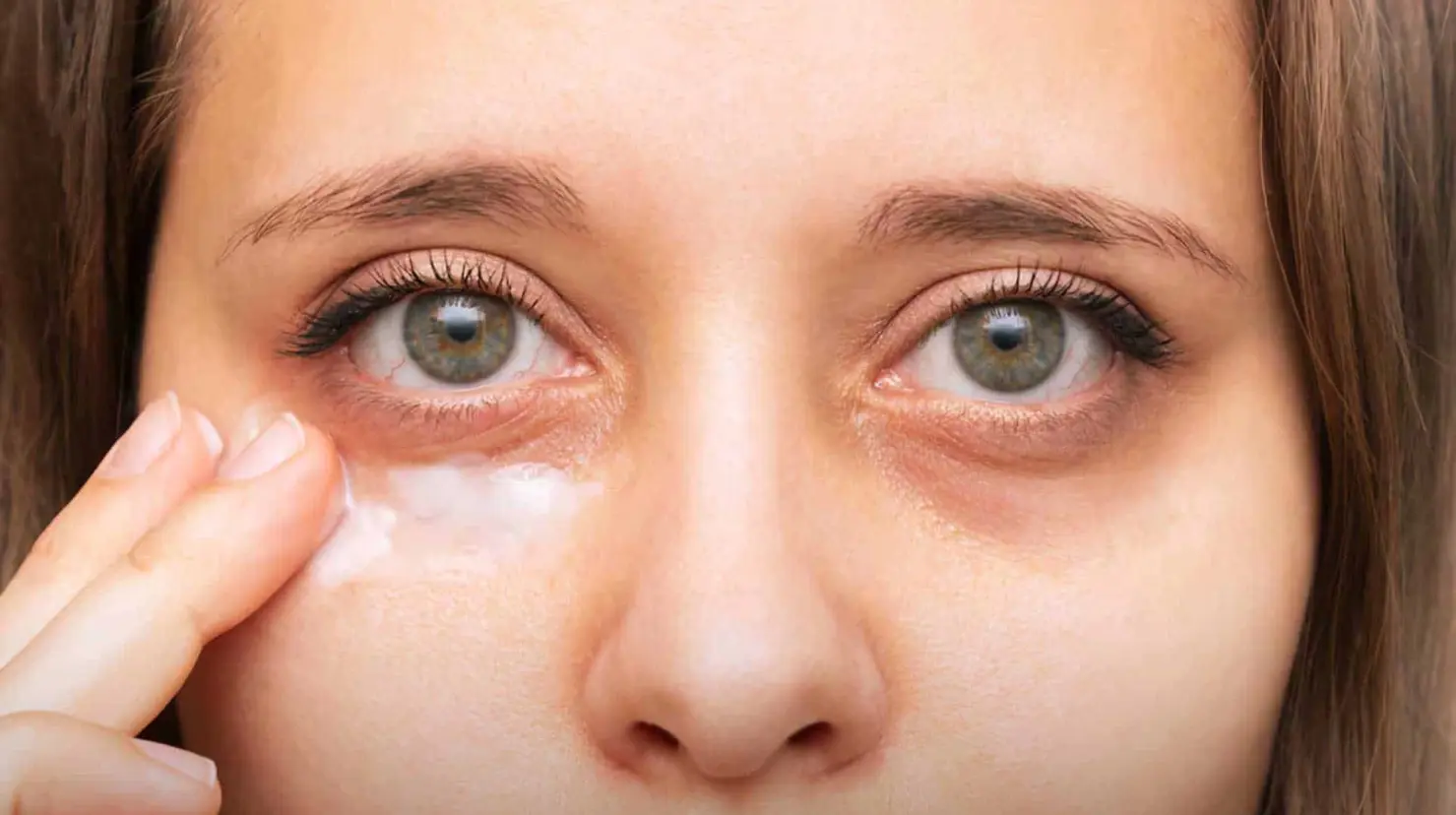 ¿Las ojeras se pueden operar? Estos son los métodos más efectivos para eliminarlas