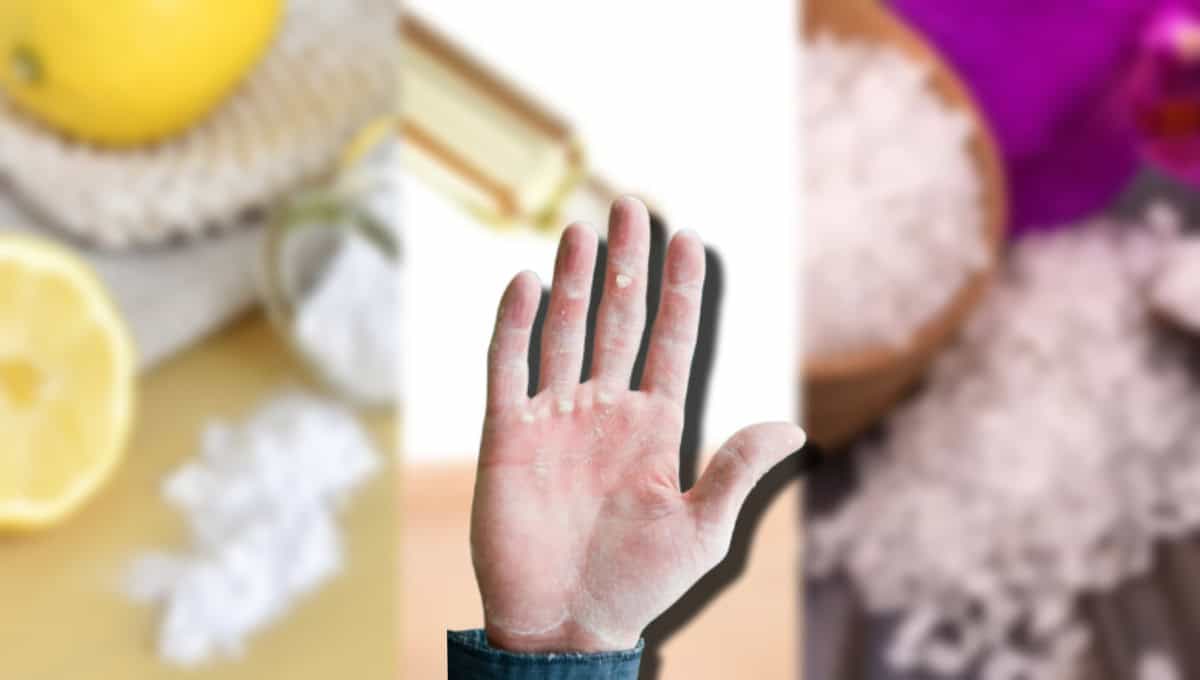 3 remedios caseros para eliminar los callos de las manos por el gimnasio