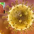 Herpes Zóster “Culebrilla”: ¿Qué personas pueden desarrollar esta dolorosa afección?