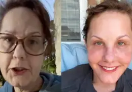 Facelift: El rejuvenecimiento de Michelle Wood tras su cirugía por Guadalajara que impacta en TikTok