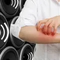 Día Mundial de la Alergia: 5 alergias poco frecuentes e insólitas que quizás no sabías que existían