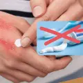 ¿Por qué NO debes aplicar pasta dental en quemaduras? Esto revelan los expertos