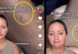 VIDEO | Influencer muestra la indignación de una madre por las heridas de su hijo. Acusa a la novia de lesiones