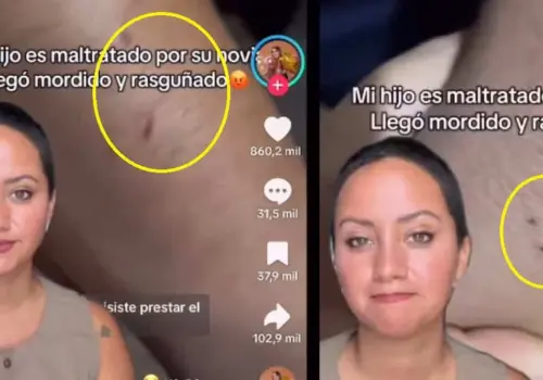 VIDEO | Influencer muestra la indignación de una madre por las heridas de su hijo. Acusa a la novia de lesiones