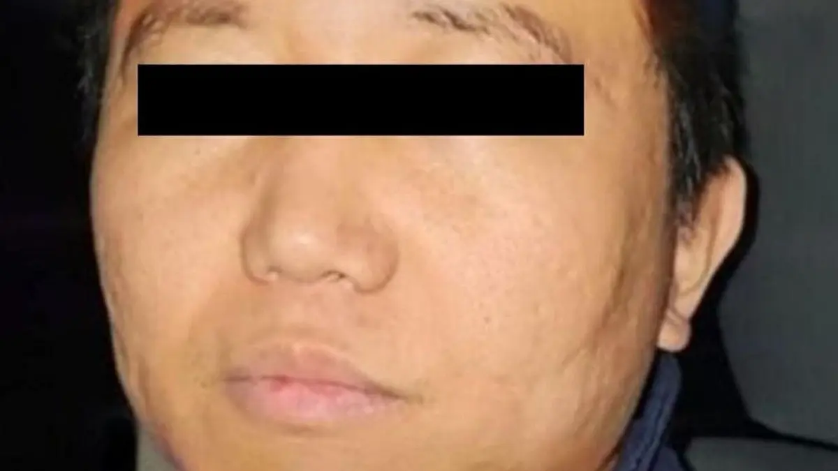 ¿Quién es Zhi Dong Zhang, operador del Cártel de Sinaloa y CJNG que se fugó de la Guardia Nacional?