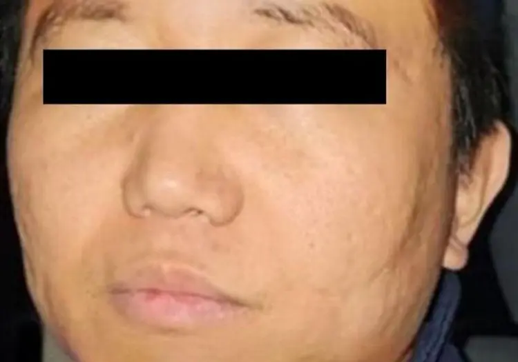 ¿Quién es Zhi Dong Zhang, operador del Cártel de Sinaloa y CJNG que se fugó de la Guardia Nacional?