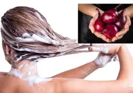 ¿Es bueno añadir cebolla al shampoo? Estos son los beneficios que podría tener