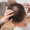 Adiós a la calvicie: Descubren moléculas que reactiva el crecimiento de cabello