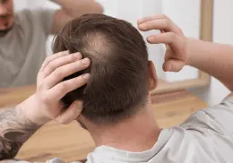 Adiós a la calvicie: Descubren moléculas que reactiva el crecimiento de cabello