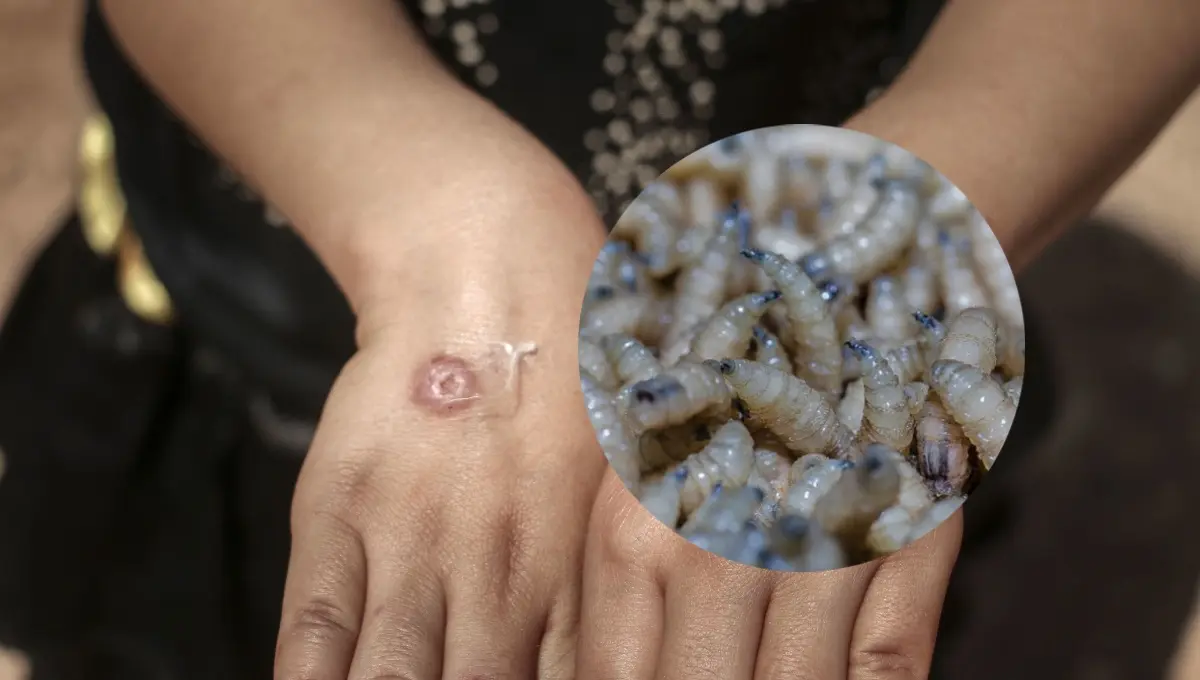 Partes del cuerpo más afectadas por el gusano barrenador en humanos. Foto: Original