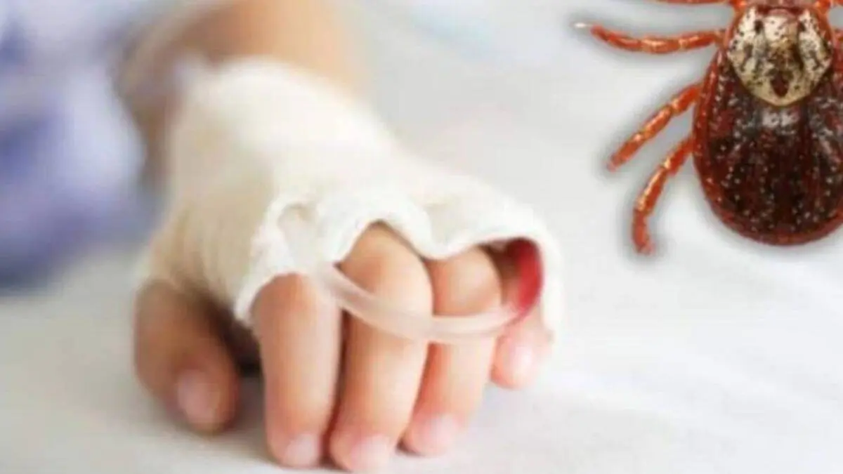 Rickettsia afecta al sur de Sonora