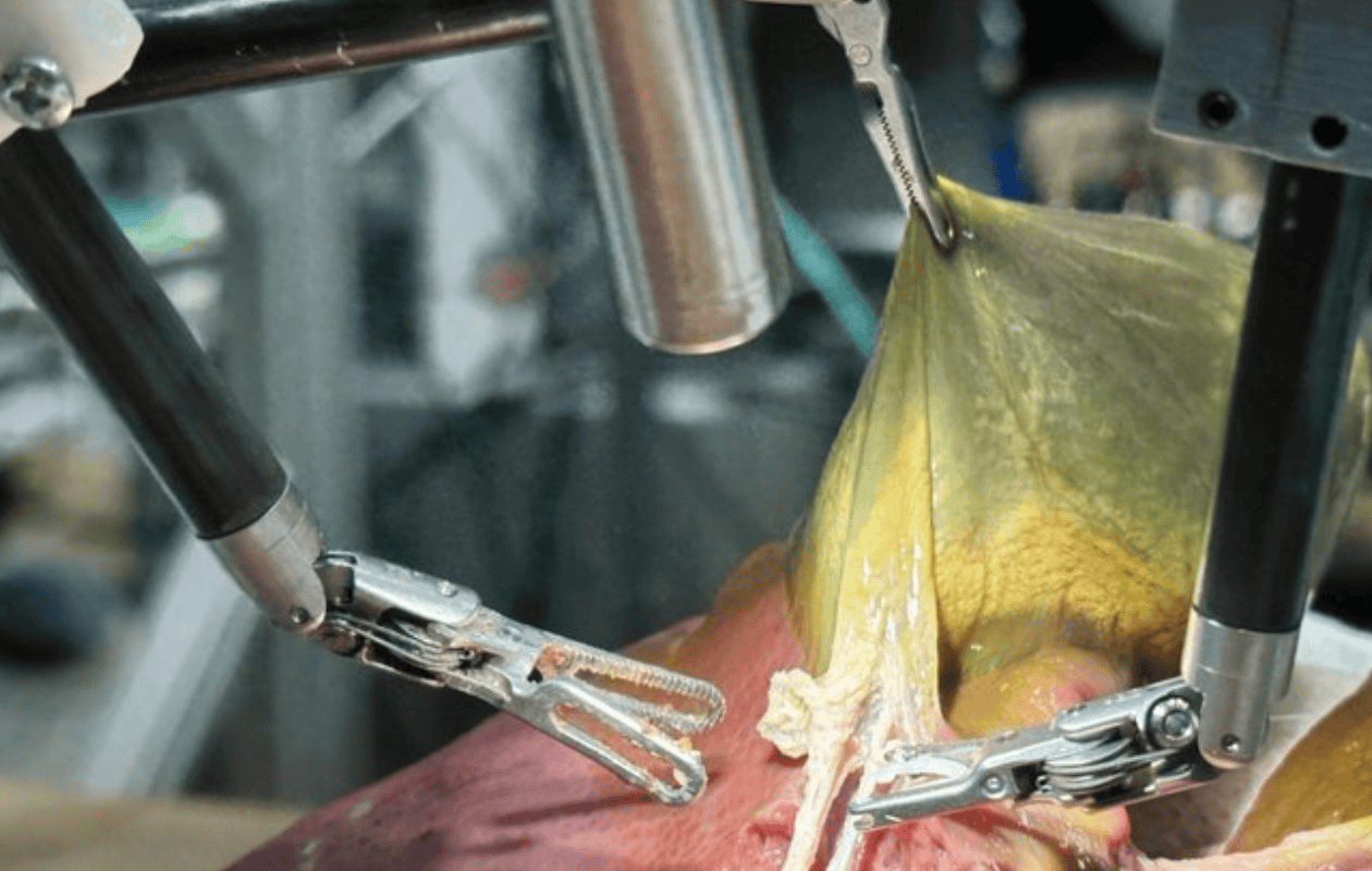 Robot con IA realiza cirugía de vesícula biliar sin asistencia humana por primera vez