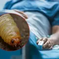 Se confirma primer fallecimiento por gusano barrenador en México