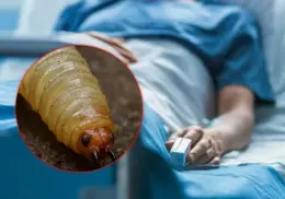 Se confirma primer fallecimiento por gusano barrenador en México