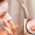Así puedes preparar una mascarilla para eliminar los puntos negros del rostro de forma natural