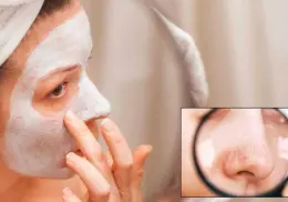 Así puedes preparar una mascarilla para eliminar los puntos negros del rostro de forma natural