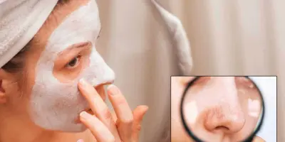 Así puedes preparar una mascarilla para eliminar los puntos negros del rostro de forma natural