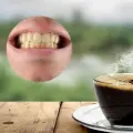 Especialistas explican si el café provoca los dientes amarillos