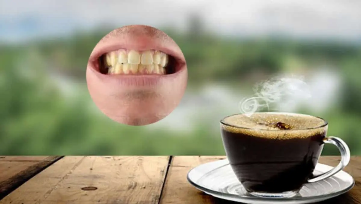 Especialistas explican si el café provoca los dientes amarillos. Foto: Original