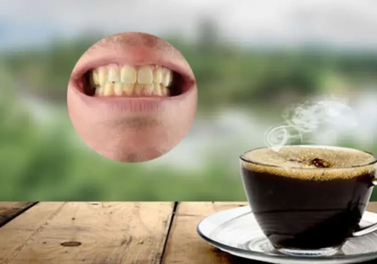 Especialistas explican si el café provoca los dientes amarillos