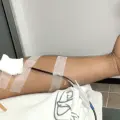 Joven dona sangre para niños en tratamiento oncológico: "No es solo sangre, es esperanza"