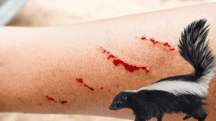 Diario del Yaqui - Zacatecas investiga posible caso de rabia en humano tras mordedura de zorrillo