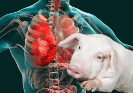China realiza el primer trasplante de pulmón de cerdo a un humano