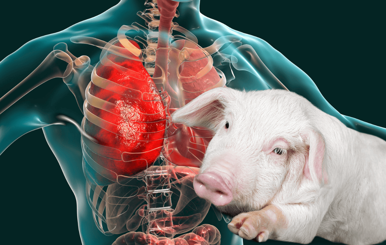 China realiza el primer trasplante de pulmón de cerdo a un humano