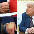 Trump muestra las mismas lesiones que la reina Isabel antes de morir; el mandatario rompe el silencio tras rumores