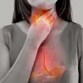 ¡Dile adiós a las agruras y la acidez! Este es el mejor remedio